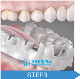 step03